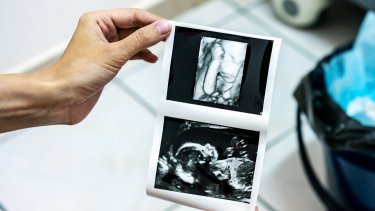 3D and 4D Ultrasounds: Are They Worth the Risk? - Mama Natural