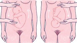 Here's how to turn your breech baby naturally and safely with 8 proven techniques. Flipping a breech baby is your best chance for a natural birth.