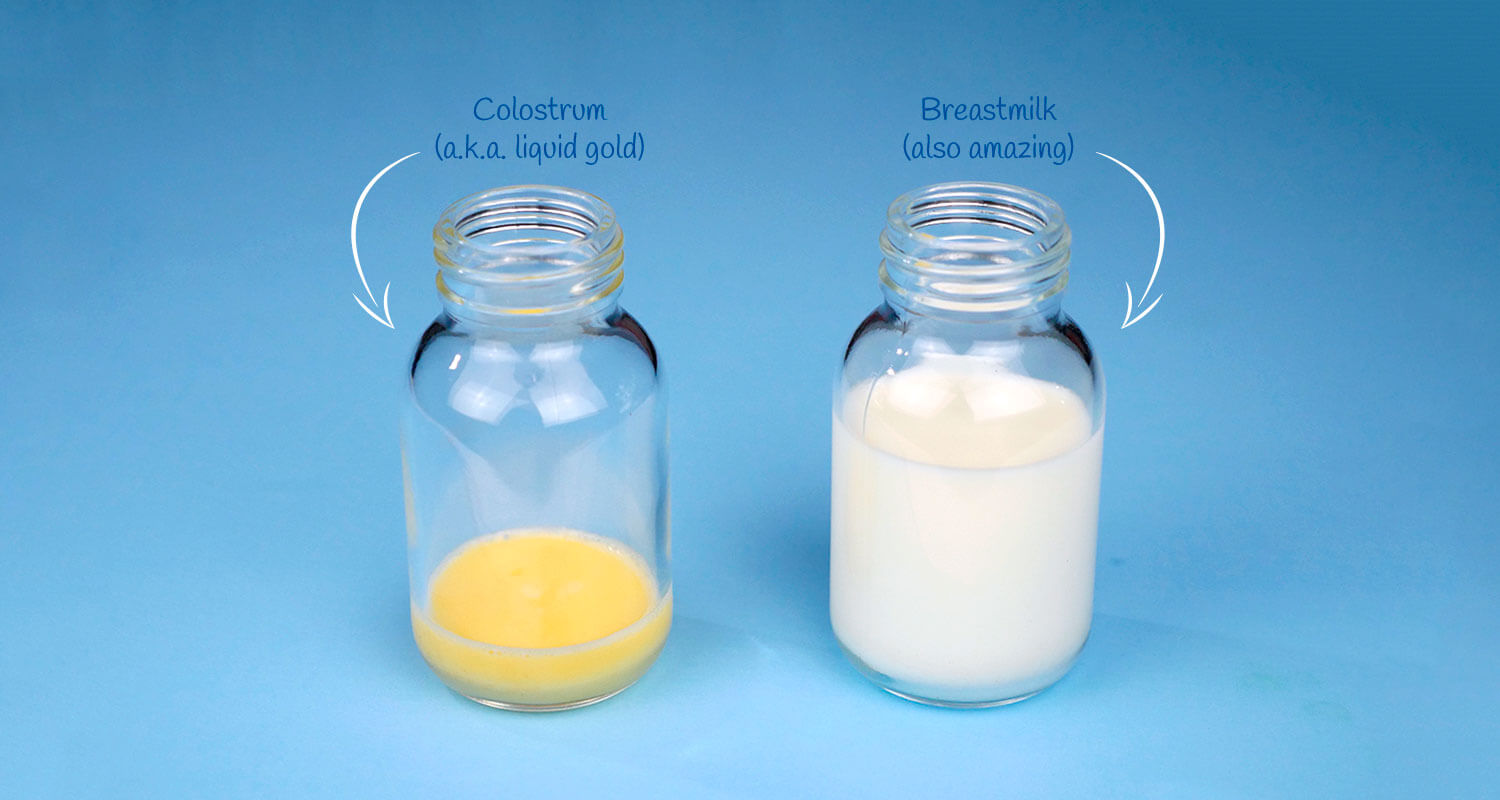 colostrum breast milk color
