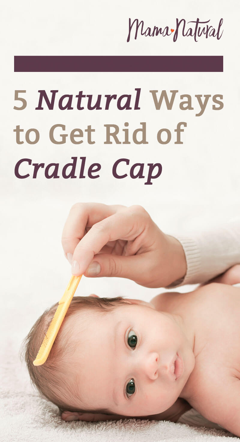How To Get Rid Of Cradle Cap On Babies Weir Phey1937