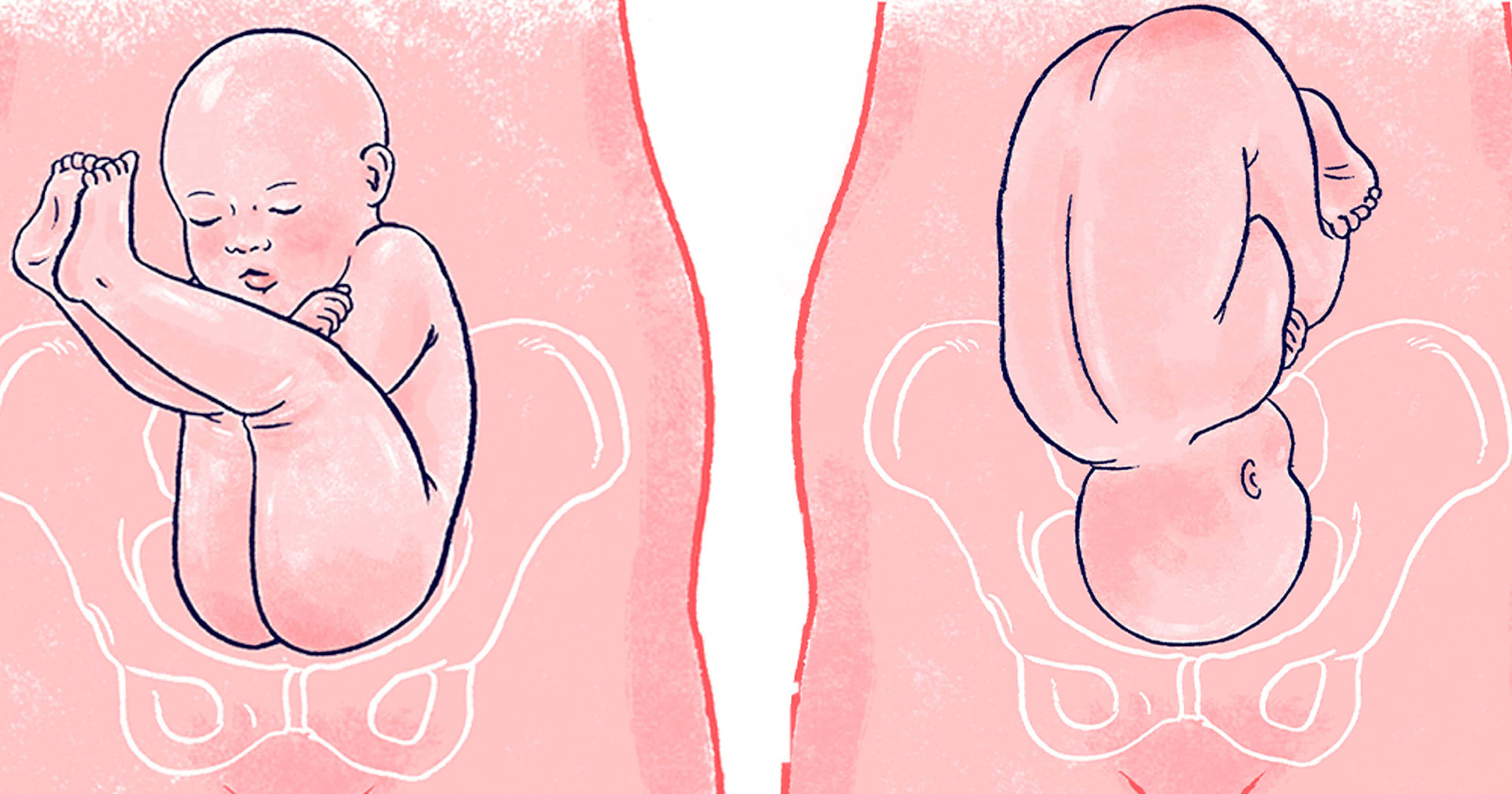 Is Your Baby in This Ideal Fetal Position? (IMAGES)