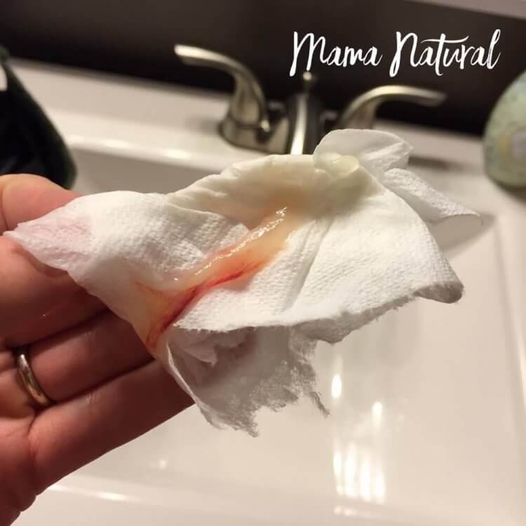 TMI Warning: Pink stringy discharge/6 weeks pregnant