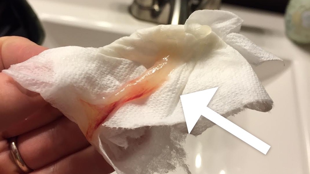 Mucus Plug: Does Labor Start When You Lose it? (Photos)
