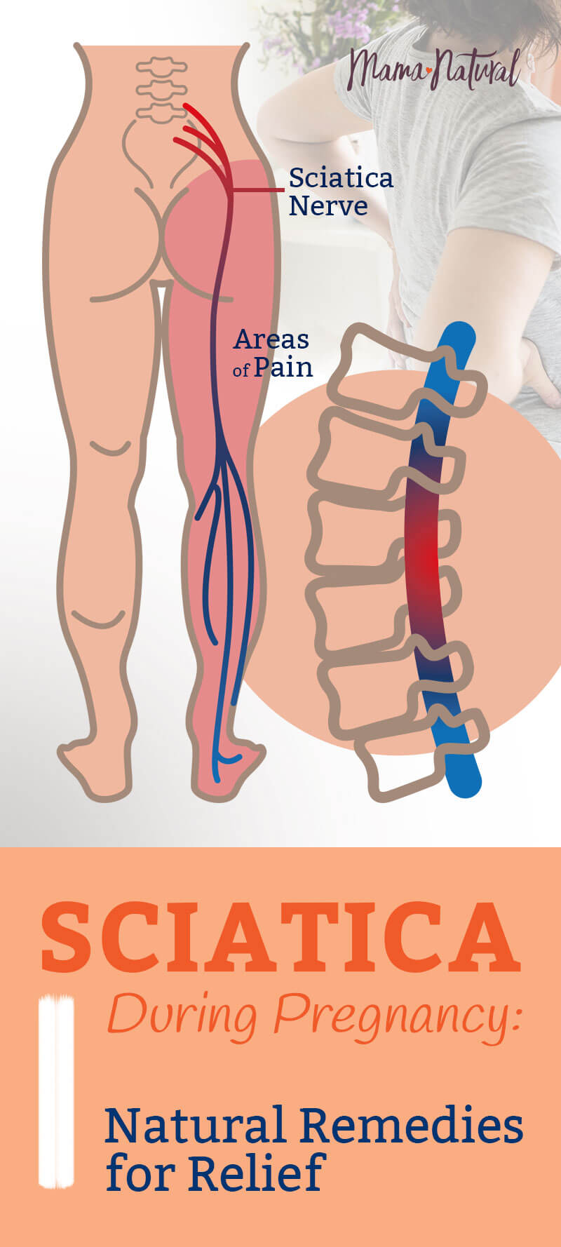 Sciatica During Pregnancy Natural Remedies For Relief