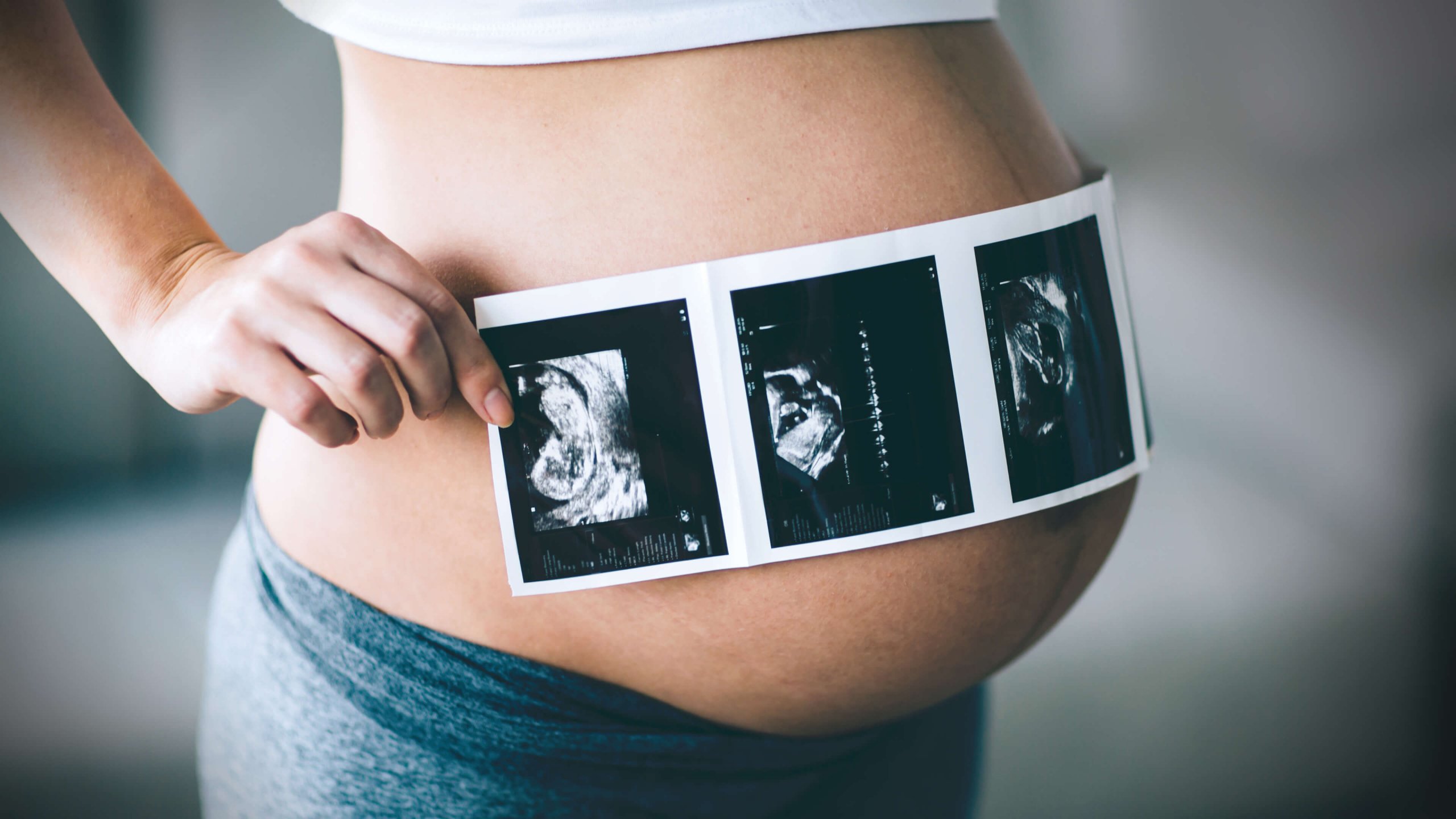 Baby Ultrasound: Risks vs. Rewards