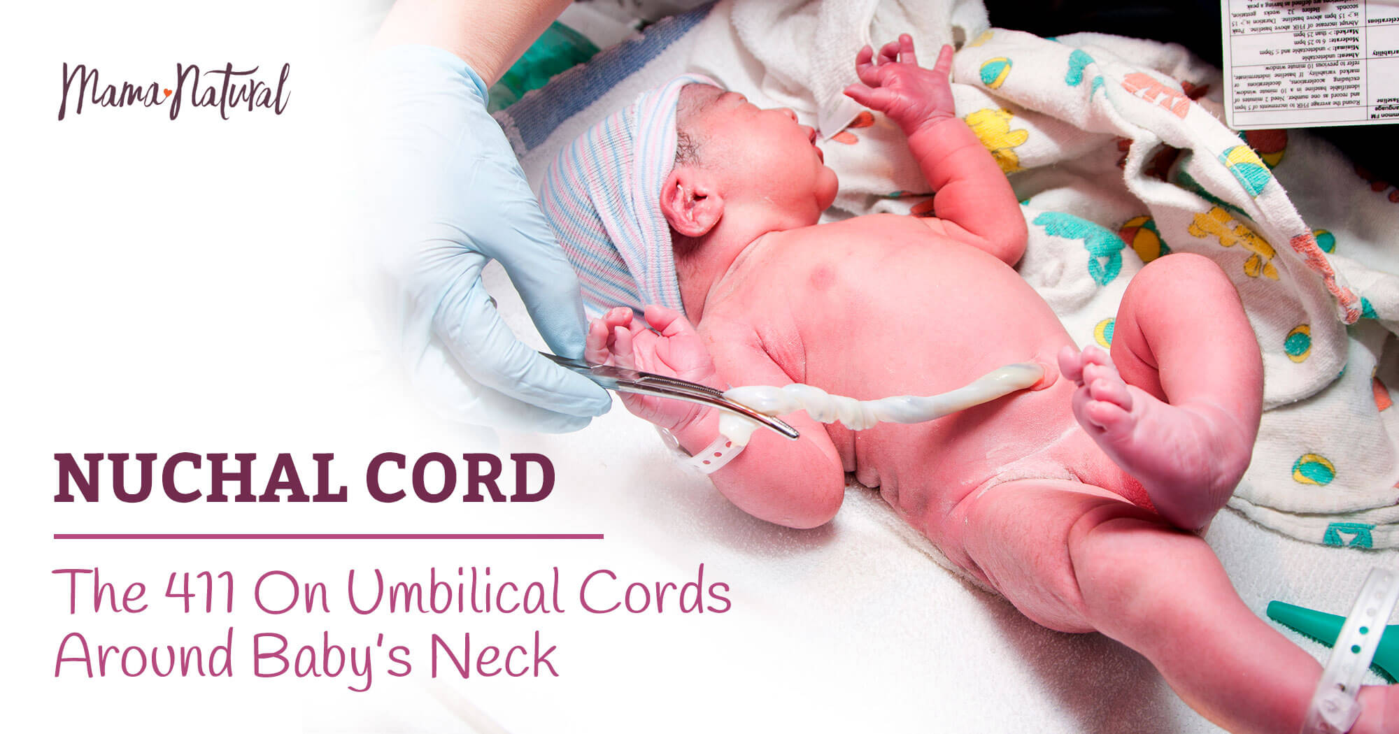 The Truth About Nuchal Cords (Umbilical Cord Around Baby’s Neck)