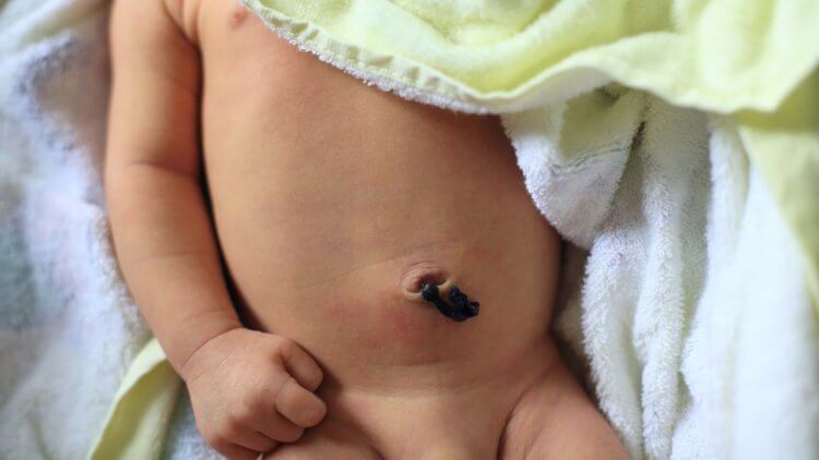 Your Baby's Umbilical Cord - Parents Powwow