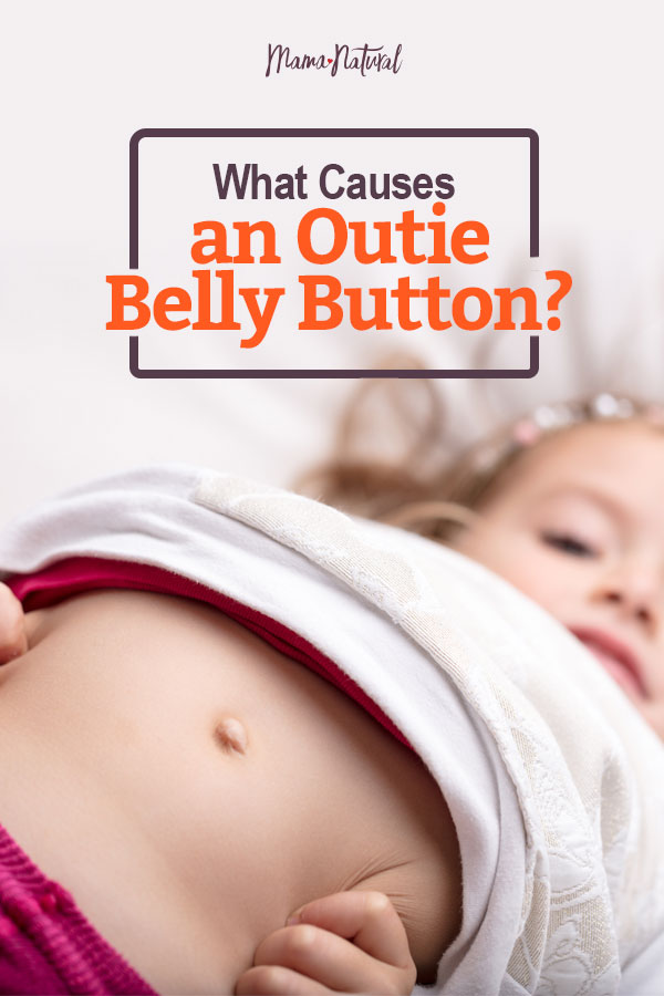What Causes An Outie Belly Button Mama Natural