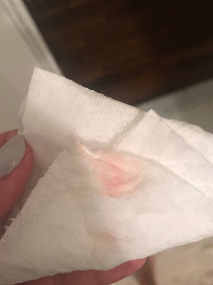5 days late. Brown discharge. Period? : r/period